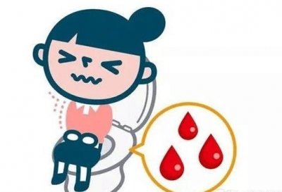大便肛門(mén)拉血是怎么回事